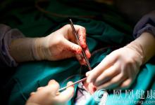 切除腫瘤最后的5%不能僅憑醫(yī)生良心