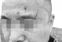 女醫(yī)生稱因不會(huì)宰病人被領(lǐng)導(dǎo)打 院長(zhǎng):她先動(dòng)手