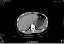 半年沒見老公太生猛,激情后她流了全身近40%的血…
