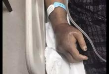 廈大回應附屬醫院院長博士論文抄襲:學術不端,不構成剽竊