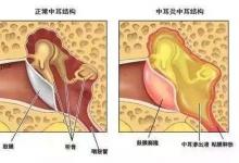 寧波22歲小伙的聽(tīng)力相當(dāng)于90歲老人!竟然是因這個(gè)習(xí)慣…看完想扔手機(jī)
