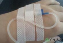 叫停成人門診輸液 輸液的注意事項(xiàng)有哪些