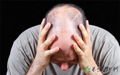 8000人報名脫發(fā)志愿者 脫發(fā)的原因有哪些 8000人報名脫發(fā)志愿者 脫發(fā)的原因有哪些