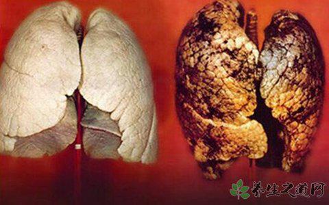 俄羅斯綠色雪 空氣污染會引起哪些疾病 俄羅斯綠色雪 空氣污染會引起哪些疾病