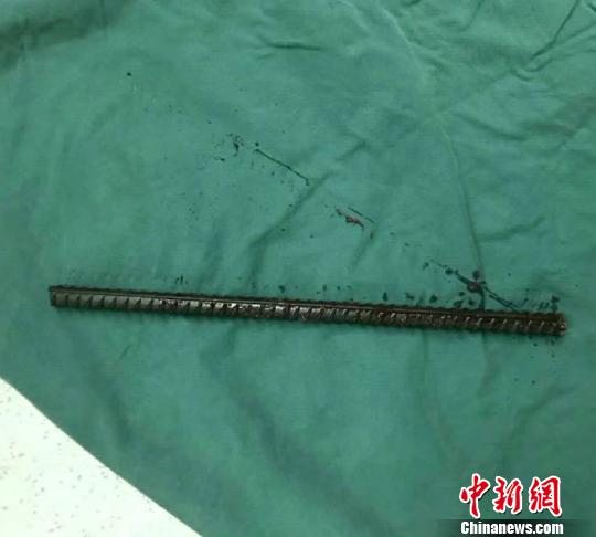 一米余長鋼筋穿破工人腹部 醫(yī)生消防協(xié)力挽回生命