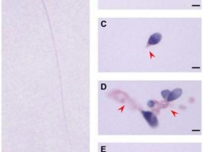 中美學(xué)者發(fā)現(xiàn)男性不孕不育新致病基因