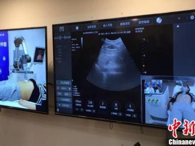 廣東省內(nèi)首例5G遠程超聲診斷在廣州應(yīng)用成功