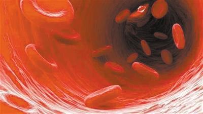 給血管“添堵”的真是“垃圾”嗎