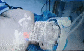 常州醫(yī)生利用MR技術做手術 宛如科幻大片