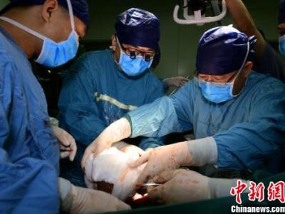 西安醫學專家利用磁輔助實施肝移植 創“無肝期”新紀錄