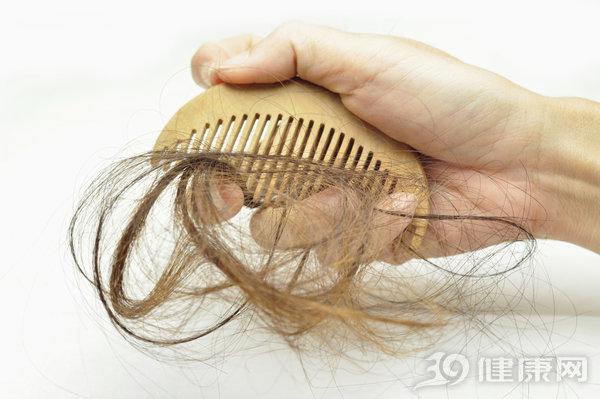 996再次躺槍:長時間工作禿頭幾率翻倍,這不是開玩笑!-易網健康養生網 996再次躺槍:長時間工作禿頭幾率翻倍,這不是開玩笑!