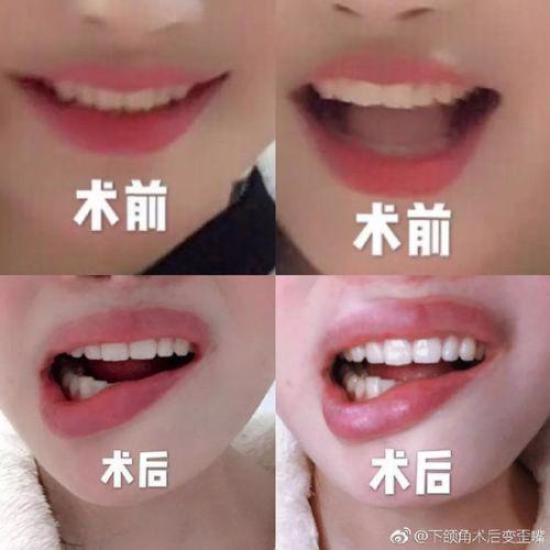 女子花3.5萬在武漢華美整形外科醫院整形致殘 院方只賠5000塊了事-易網健康養生網 女子花3.5萬在武漢華美整形外科醫院整形致殘 院方只賠5000塊了事