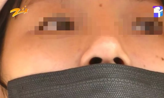 杭州甄美整形醫院把人鼻子整歪了?醫院:自己長歪了-易網健康養生網 杭州甄美整形醫院把人鼻子整歪了?醫院:自己長歪了