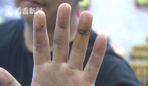 通州灣三余人民醫(yī)院為男病人配婦科用藥?院方:拿錯了-易網(wǎng)健康<a href=http://www.xllyou.com/jkys/ target=_blank class=infotextkey>養(yǎng)生</a>網(wǎng) 通州灣三余人民醫(yī)院為男病人配婦科用藥?院方:拿錯了