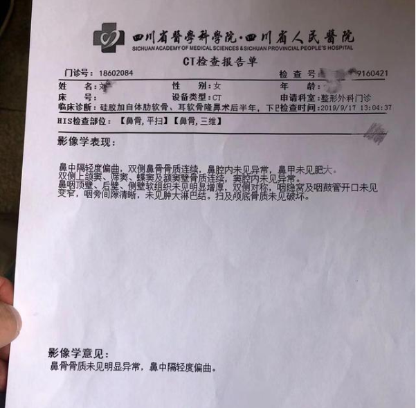 年輕姑娘花了11萬整形把鼻子整歪了 成都正好醫學美容:需鑒定-易網健康養生網 年輕姑娘花了11萬整形把鼻子整歪了 成都正好醫學美容:需鑒定