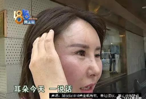 女子稱被整成了怪物 杭州格萊美醫院：藥物擴散導致