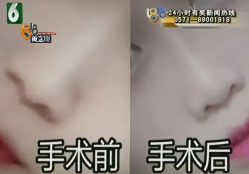 杭州世彩整形又遭消費者投訴 采訪時院方代表有些激動-易網<a href=http://www.xllyou.com/ target=_blank class=infotextkey>健康養生</a>網 杭州世彩整形又遭消費者投訴 采訪時院方代表有些激動