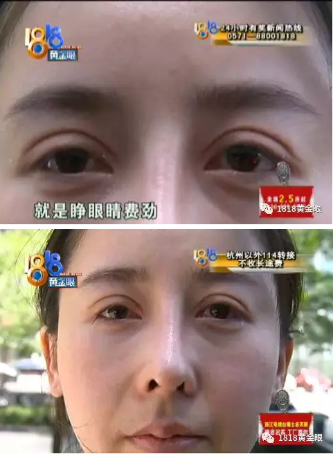 花八萬多在杭州顏控國際醫(yī)療美容后比以前還丑 她說著說著流淚了-易網(wǎng)<a href=http://www.xllyou.com/ target=_blank class=infotextkey>健康養(yǎng)生</a>網(wǎng) 花八萬多在杭州顏控國際醫(yī)療美容后比以前還丑 她說著說著流淚了