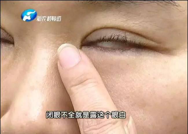 女子整形失敗 許昌華姿醫美整形醫院不認：因為醫生已離職