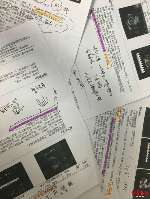 德陽市人民醫院產檢生下畸形兒:醫院稱符合診療規范 父親拒帶回家-易網健康<a href=http://www.xllyou.com/jkys/ target=_blank class=infotextkey>養生</a>網 德陽市人民醫院產檢生下畸形兒:醫院稱符合診療規范 父親拒帶回家