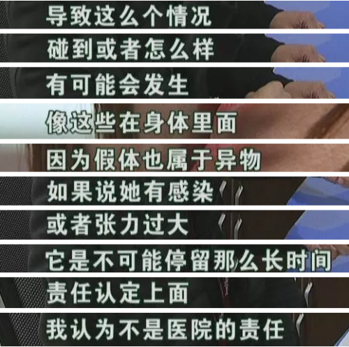 六年前在寧波珈禾整形專科醫院做隆鼻 現在鼻子不舒服露出白色假體