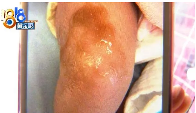 杭州馨紫羅蘭月子會所坐月子 媽媽跟寶寶都燙傷了?-易網<a href=http://www.xllyou.com/ target=_blank class=infotextkey>健康養生</a>網 杭州馨紫羅蘭月子會所坐月子 媽媽跟寶寶都燙傷了?