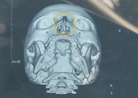 南昌普拉醫(yī)療美容醫(yī)院怎么樣?女子花8000整形失敗獲全額退款-易網(wǎng)<a href=http://www.xllyou.com/ target=_blank class=infotextkey>健康養(yǎng)生</a>網(wǎng) 南昌普拉醫(yī)療美容醫(yī)院怎么樣?女子花8000整形失敗獲全額退款