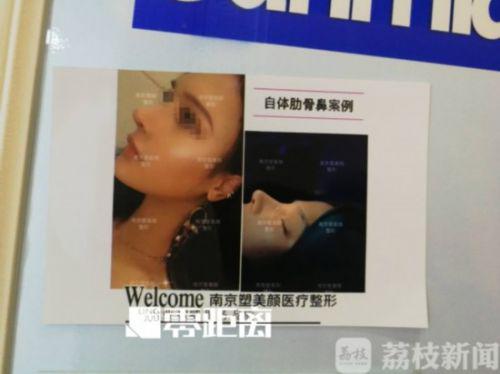 南京塑美顏整形門診涉嫌超范圍經營 女孩隆鼻后鼻孔大小不一