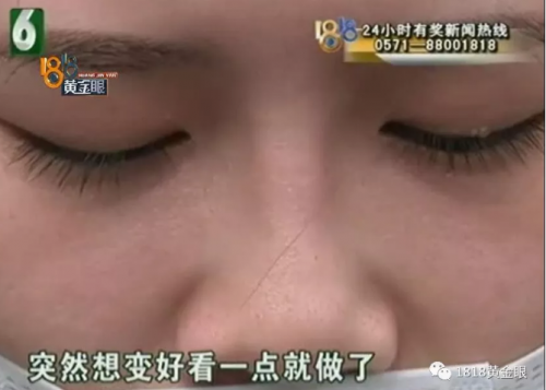 杭州世彩整形又遭消費者投訴 采訪時院方代表有些激動-易網健康養生網 杭州世彩整形又遭消費者投訴 采訪時院方代表有些激動