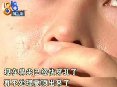 杭州麗星整形醫(yī)院整壞了鼻子至妍醫(yī)療美容來修復 醫(yī)院更名了?