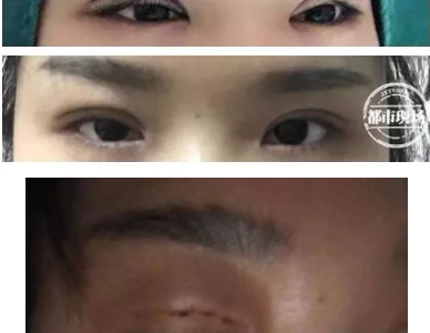 南昌愛玩美皮膚身材管理中心涉嫌無證行醫 女子花5800元整形失敗