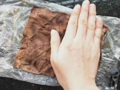 福建一女子順產，紗布留體內30天！建陽第一醫院：不算罕見