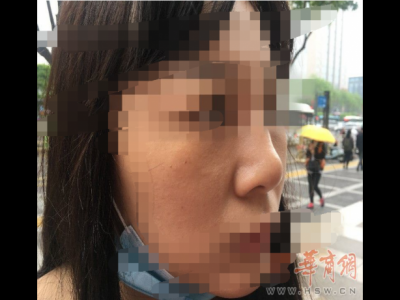 西安藝星美容整形醫院：醫美沒有統一標準 鼻子凹凸不平屬于正常