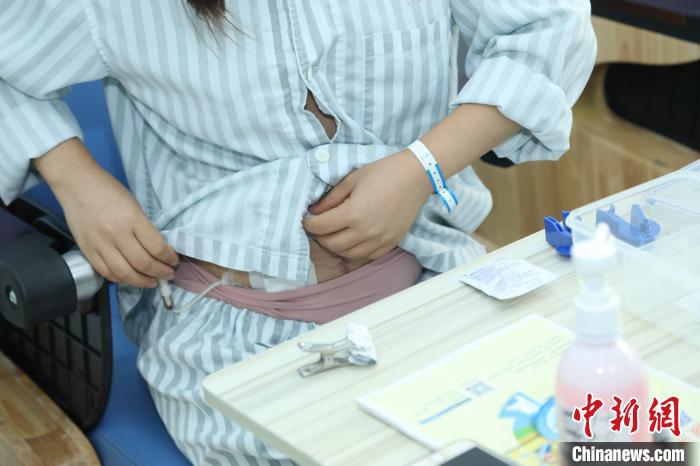 首個智慧腹膜透析中心廣東啟動 緩解偏遠地區患者血透難