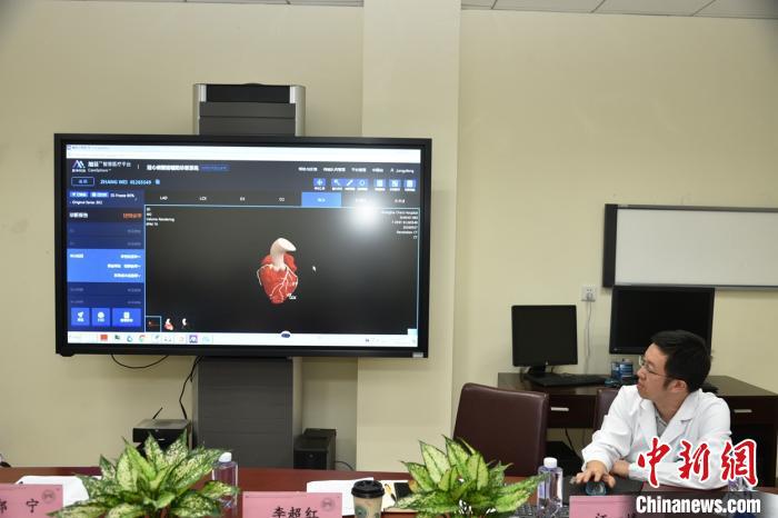 AI系統(tǒng)+CT掃描升級  智慧冠脈CT輻射劑量、等候時間雙下降