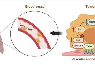 學(xué)者發(fā)現(xiàn)常用靜脈麻醉藥丙泊酚或增加腫瘤侵襲、轉(zhuǎn)移風(fēng)險(xiǎn)