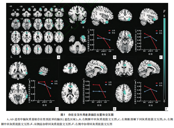 男女有別:患上阿爾茲海默癥后,女性活得更難!-易網健康養生網 男女有別:患上阿爾茲海默癥后,女性活得更難!