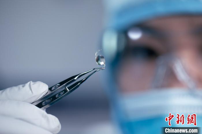 國家重點研發(fā)計劃項目新一代人工晶狀體進入臨床階段