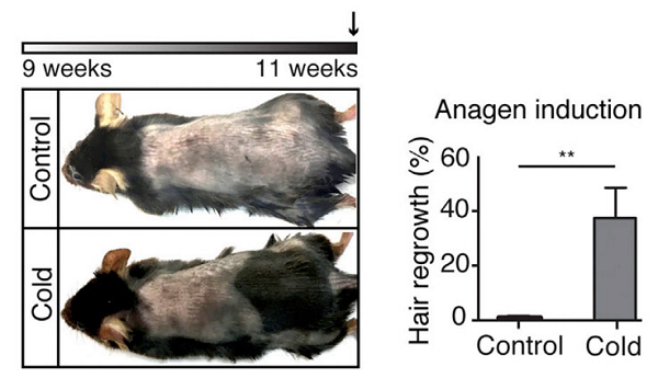 禿頭有救啦!一身雞皮疙瘩竟與生發(fā)有關(guān),禿頭青年必看-易網(wǎng)健康養(yǎng)生網(wǎng) 禿頭有救啦!一身雞皮疙瘩竟與生發(fā)有關(guān),禿頭青年必看
