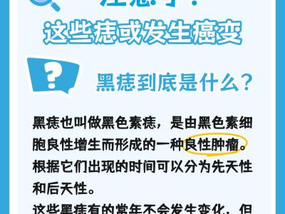 身上有痣的人注意了！這些痣可能會發生癌變