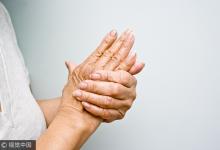 喝水加它竟能防痛風?尿酸高牢記6大飲食禁忌可保命!