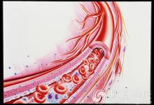 忽視6個細節，血管早晚堵