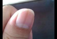 指甲已經發出健康預警了,你還蒙在鼓里!