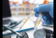 小便后看一眼就能保命,這種顏色是大病征兆