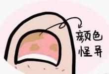 茄子這樣吃，勝過(guò)10副藥