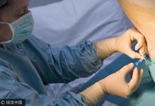 腳腫、腳痛，6個(gè)腳上癥狀告訴你，身體早有疾病！