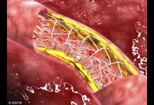 血管堵了,全身遭殃,這個動作讓全身血液流通起來