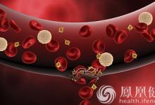 99%的血栓無征兆!記住一個字,就能遠離全身血栓