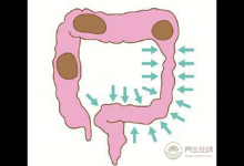 食療養生:常吃這些食物能養胃