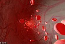 92歲老人血管壁光滑如29歲小年輕，只因吃它